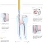 endo-guaaard-final