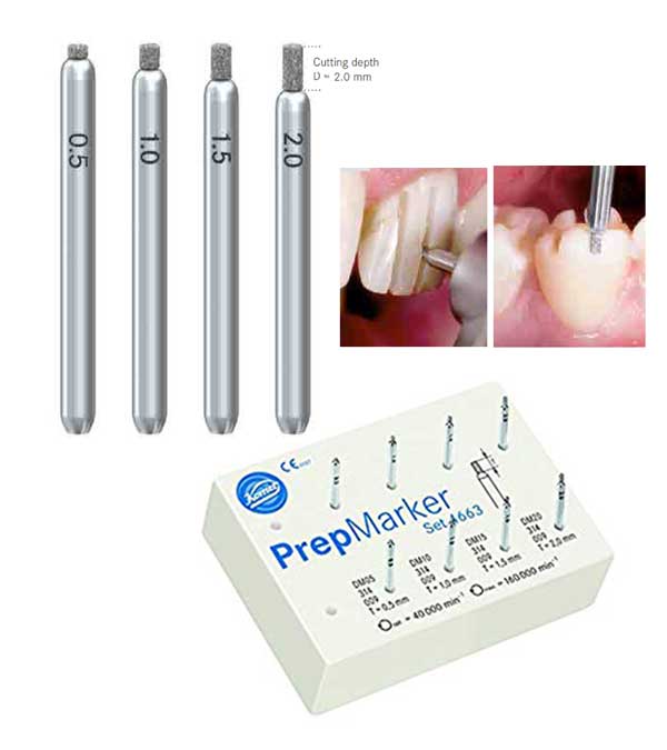 Komet-Prep-Marker-Kit